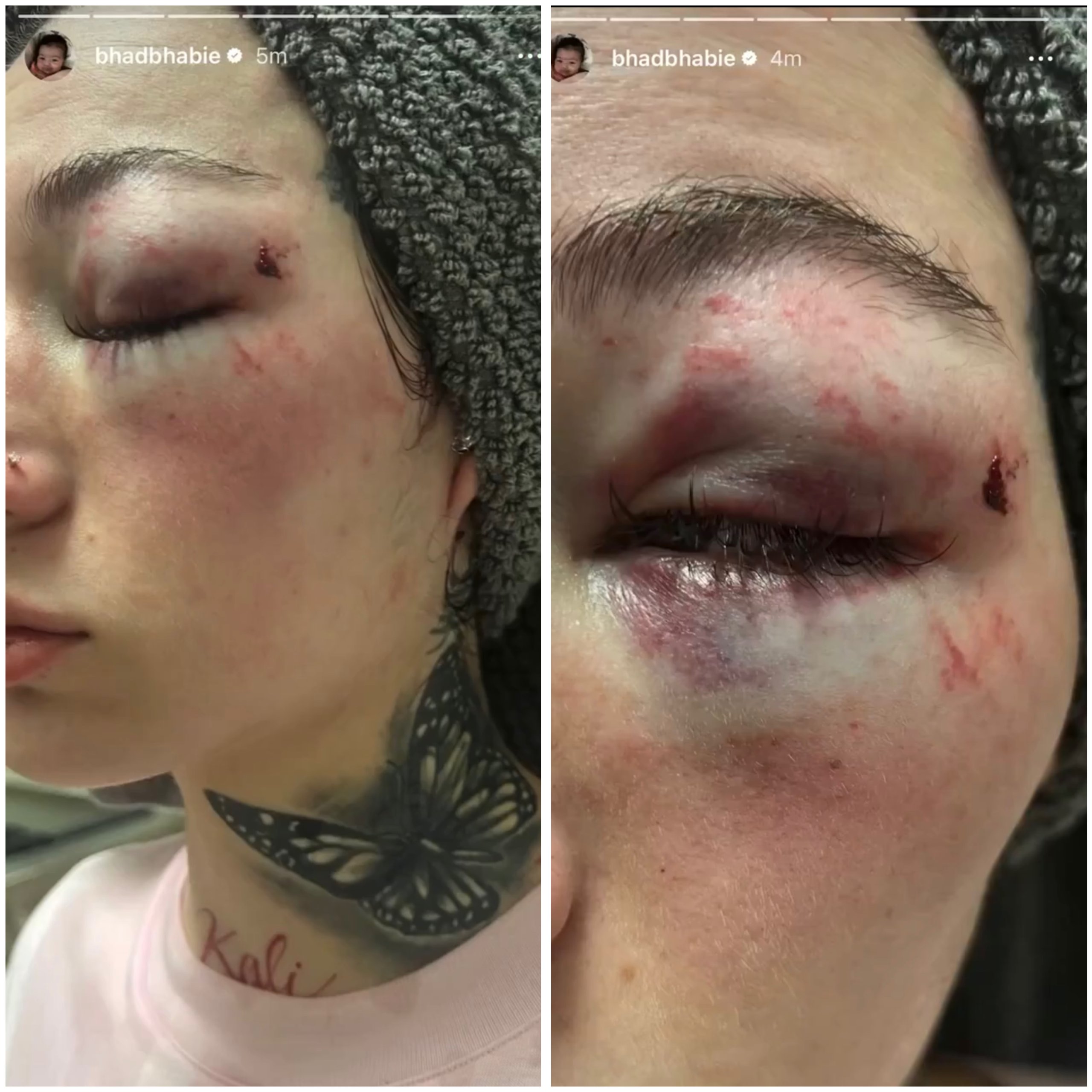 Bhad Bhabie Shares Video & Photos Of Her Ex Boyfriend/Baby Daddy Assaulting Her