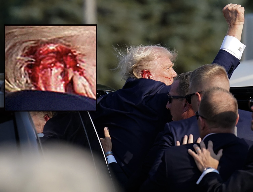 Close Up Pics Of Trump’s Healed Ear Sparks Rumor Assassination Was A Hoax