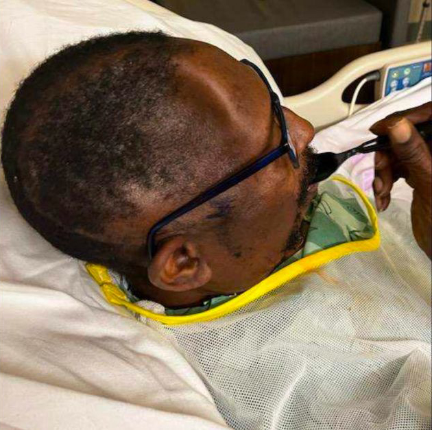 Georgia Man Sues Atlanta Hospital For Charging Him $19K For The Synthetic Replacement Of A Lost Piece Of Skull